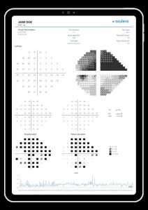 optimedic-portfolio-oculera-3